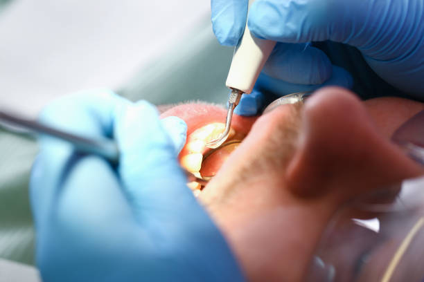 Best Broken or Cracked Tooth Emergency Dentist in Edgerton, OH